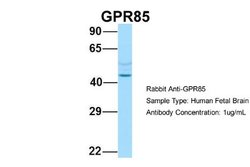 GPR85 Rabbit anti-Human, Polyclonal, Novus Biologicals 0.1 mL; Unconjugated:Antibodies,